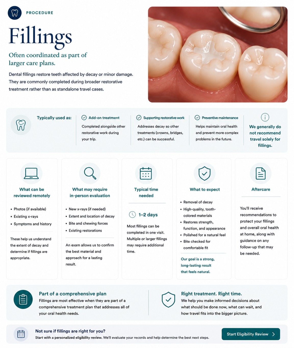Fillings — procedure overview